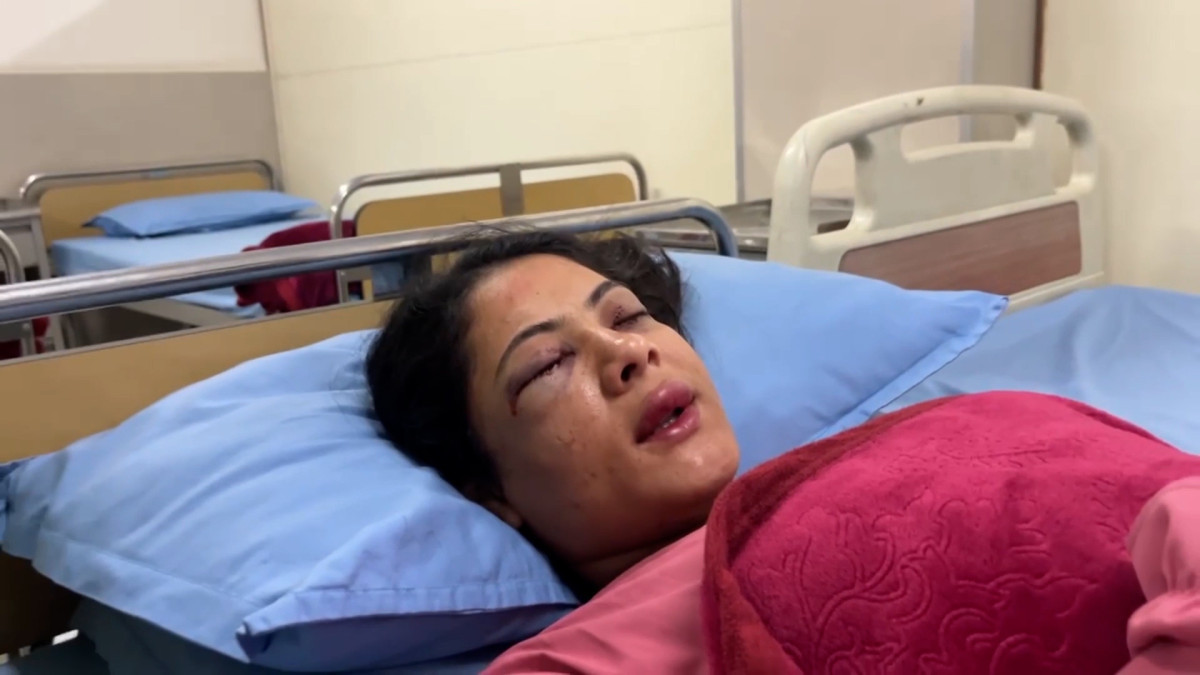 शिक्षक–प्रहरीबीचको झडपमा पत्रकार कार्की घाइते, तिलगंगा आँखा अस्पतालमा उपचार हुँदै
